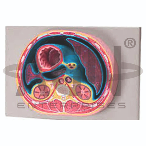 AJKANT Schematic Cross Section Through Thorax (T12) (Model: AJK-BILA-13493)