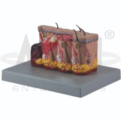 AJKANT Pathological Model Of Burned Skin (Model: AJK-BILA-12974)
