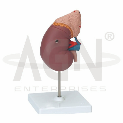 AJKANT Kidney With Adrenal Gland(Life Size) (Model: AJK-BILA-12887)