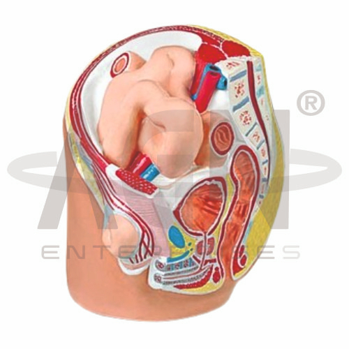 AJKANT Indirect Inguinal Hernia (Model: AJK-BILA-12879)