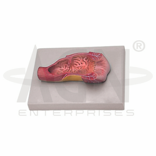 AJKANT Human Anus Model (Model: AJK-BILA-12840)