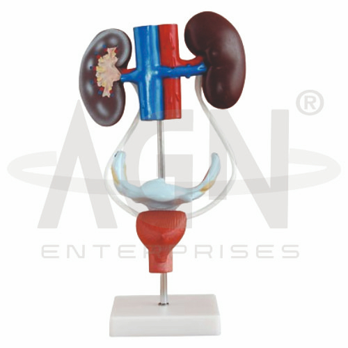 AJKANT Female Urogenital System (Model: AJK-BILA-12803)