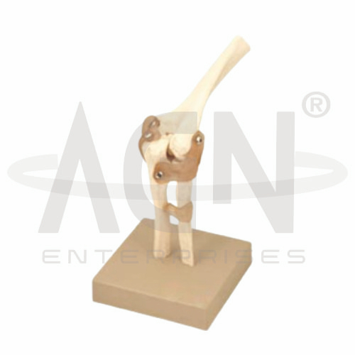 AJKANT Elbow Joint (Model: AJK-BILA-12778)